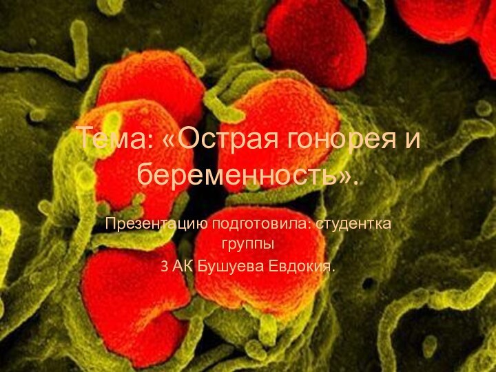 Тема: «Острая гонорея и беременность».Презентацию подготовила: студентка группы 3 АК Бушуева Евдокия.