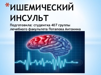 ИШЕМИЧЕСКИЙ ИНСУЛЬТ Подготовила: студентка 407 группы лечебного факультета Потапова Антонина