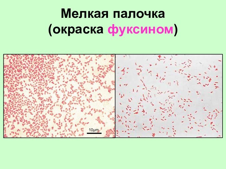 Мелкая палочка  (окраска фуксином)