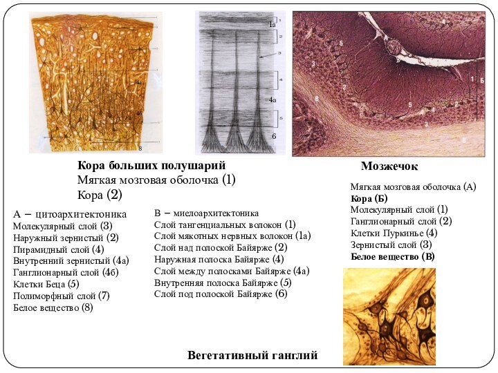 Кора больших полушарийМягкая мозговая оболочка (1)Кора (2)А – цитоархитектоникаМолекулярный слой (3)Наружный зернистый
