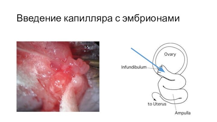 Введение капилляра с эмбрионами