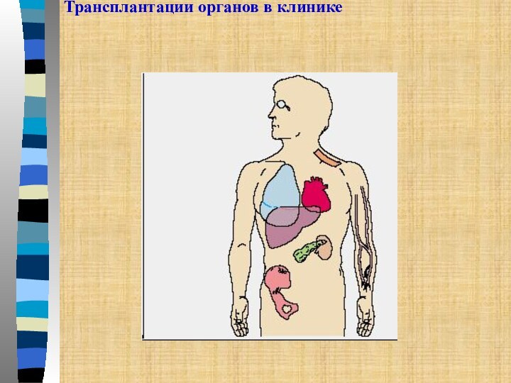 Трансплантации органов в клинике