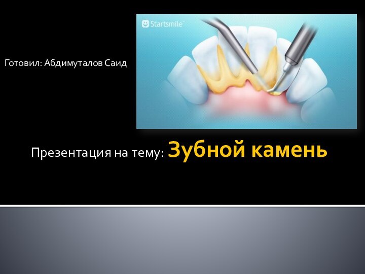 Презентация на тему: Зубной камень Готовил: Абдимуталов Саид