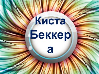 Киста Беккера