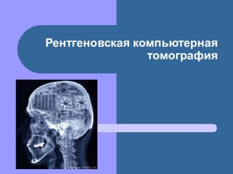 Рентгеновская компьютерная томография