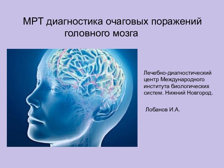 Лечебно-диагностический центр Международного института биологических систем. Нижний Новгород. Лобанов И.А.МРТ диагностика очаговых