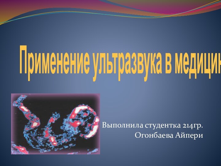 Применение ультразвука в медицине Выполнила студентка 214гр. Огонбаева Айпери