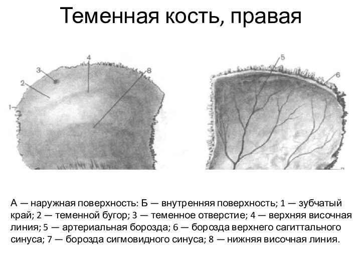 Теменная кость, праваяА — наружная поверхность: Б — внутренняя поверхность; 1 —