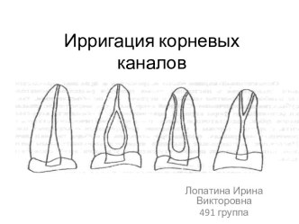 Ирригация корневых каналов