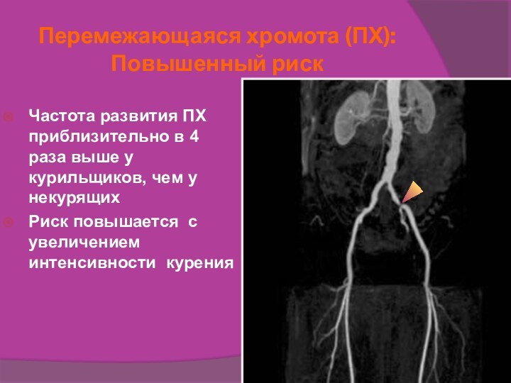 Перемежающаяся хромота (ПХ): Повышенный рискЧастота развития ПХ приблизительно в 4 раза выше