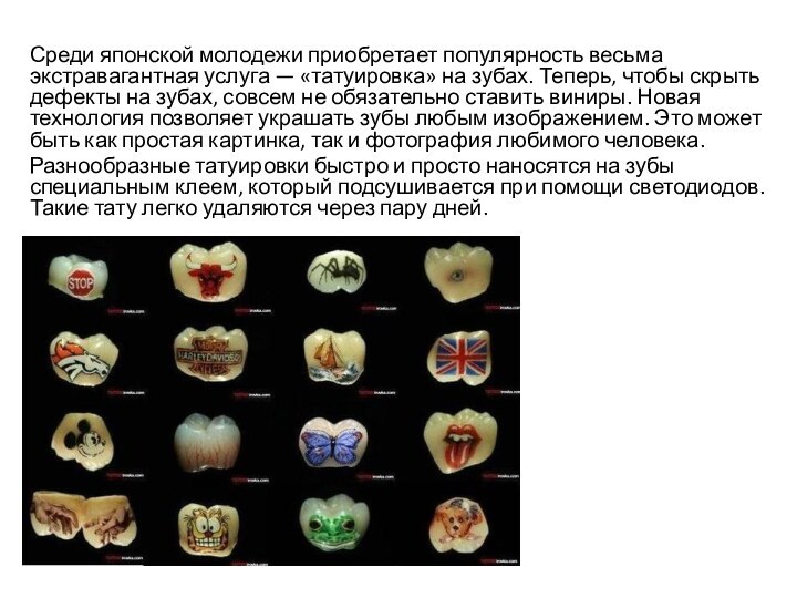 Среди японской молодежи приобретает популярность весьма экстравагантная услуга — «татуировка» на зубах.