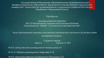 Изготовление съемных пластиночных протезов при частичном отсутствии зубов на верхней челюсти