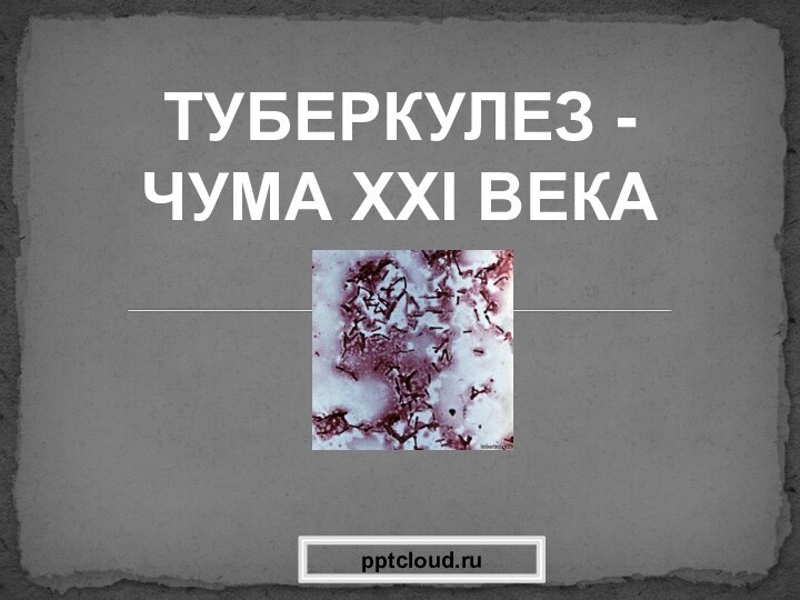 ТУБЕРКУЛЕЗ -ЧУМА ХХІ ВЕКА