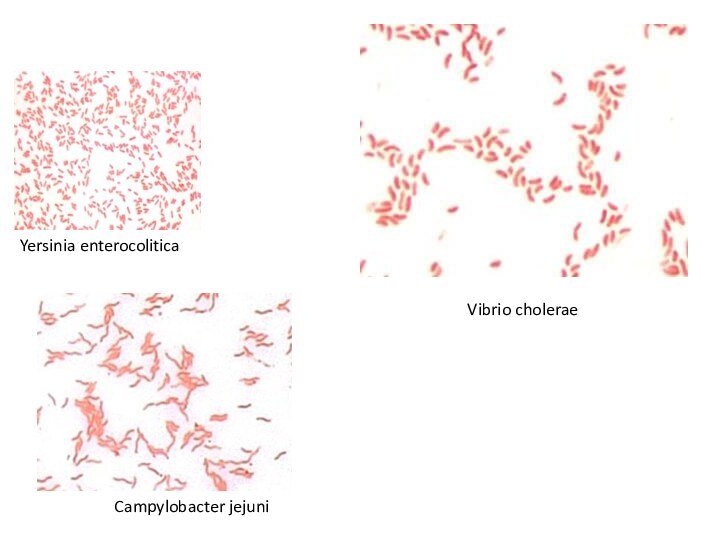 Campylobacter jejuniVibrio choleraeYersinia enterocolitica