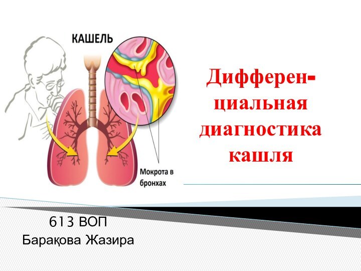 Дифферен- циальная диагностика кашля613 ВОПБарақова Жазира