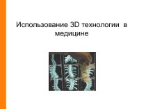 Использование 3D технологии в медицине