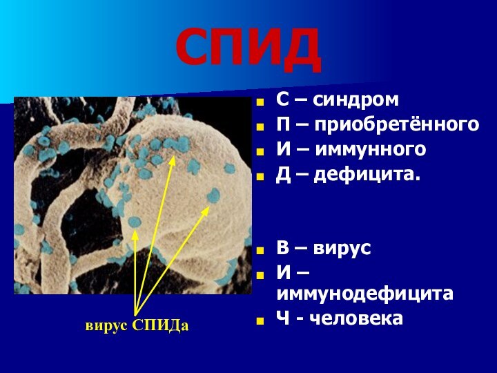 СПИДС – синдромП – приобретённогоИ – иммунногоД – дефицита.В – вирусИ – иммунодефицитаЧ - человекавирус СПИДа