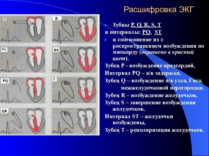 Расшифровка ЭКГЗубцы P, Q, R, S, T и интервалы: PQ, STи соотношение