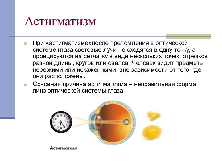 АстигматизмПри «астигматизме»после преломления в оптической системе глаза световые лучи не сходятся в