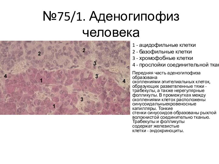 №75/1. Аденогипофиз человекаПередняя часть аденогипофиза образована скоплениями эпителиальных клеток, образующих разветвленные тяжи - трабекулы, а