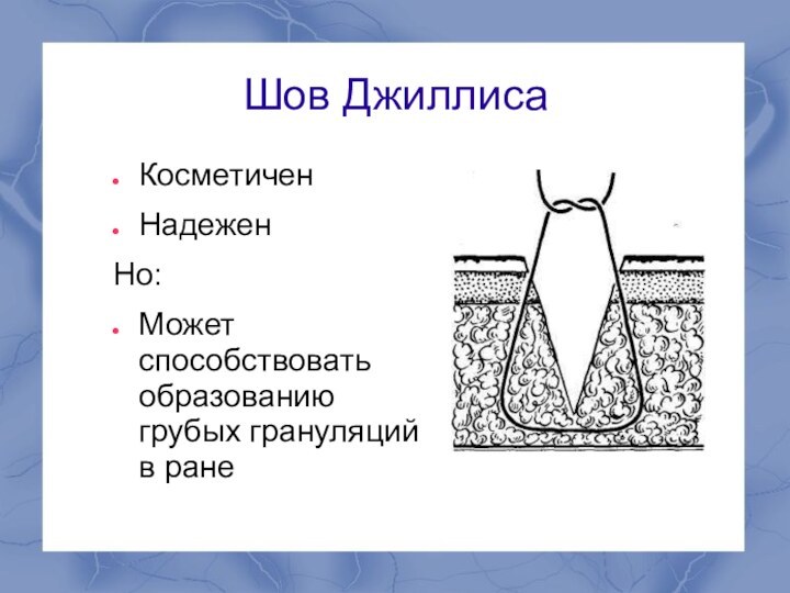 Шов ДжиллисаКосметиченНадеженНо: Может способствовать образованию грубых грануляций в ране