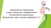 Заживление переломовв рентгеновском изображении.Осложнения переломов. Выполнила: врач интерн Авдеева Е. С.