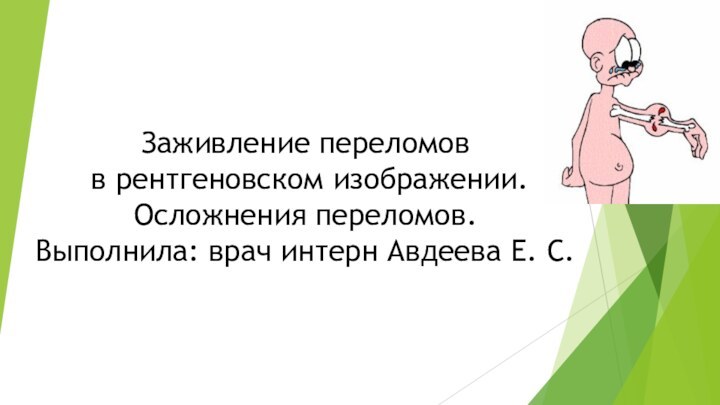 Заживление переломов  в рентгеновском изображении. Осложнения переломов.  Выполнила: врач интерн Авдеева Е. С.