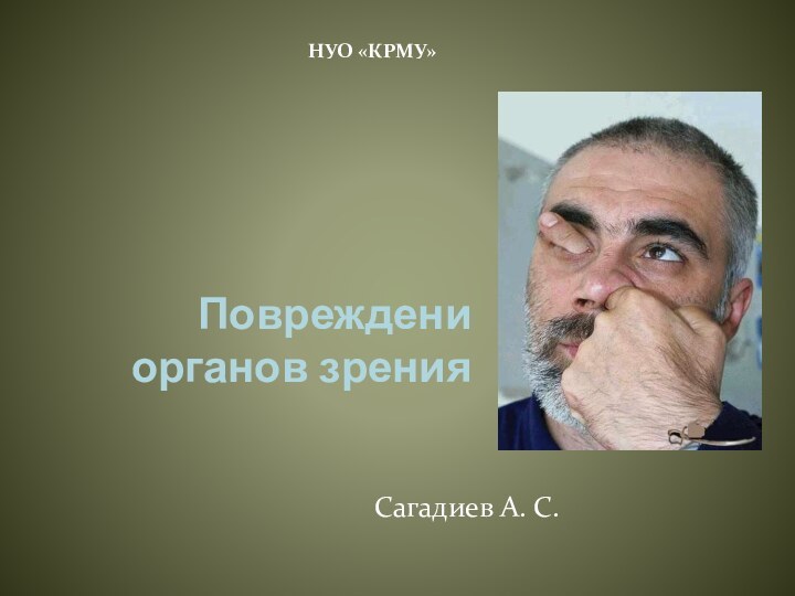 Повреждени органов зренияСагадиев А. С.НУО «КРМУ»