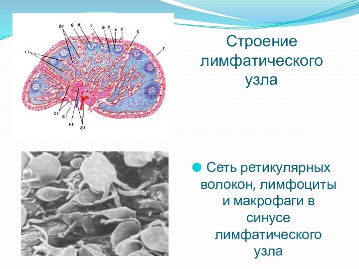 Строение лимфатического узла Сеть ретикулярных волокон, лимфоциты и макрофаги в синусе лимфатического узла