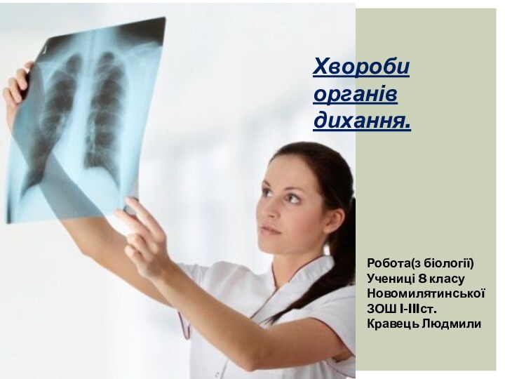 Хвороби органів дихання.Робота(з біології)Учениці 8 класуНовомилятинськоїЗОШ I-IIIст.Кравець Людмили