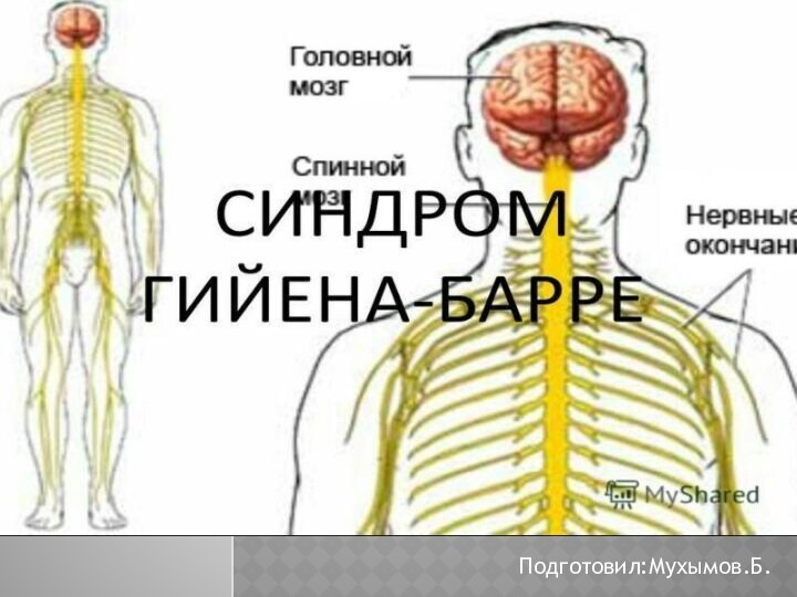 Синдром Гийена-БарреПодготовил:Мухымов.Б.