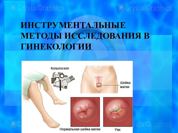 ИНСТРУМЕНТАЛЬНЫЕ МЕТОДЫ ИССЛЕДОВАНИЯ В ГИНЕКОЛОГИИ