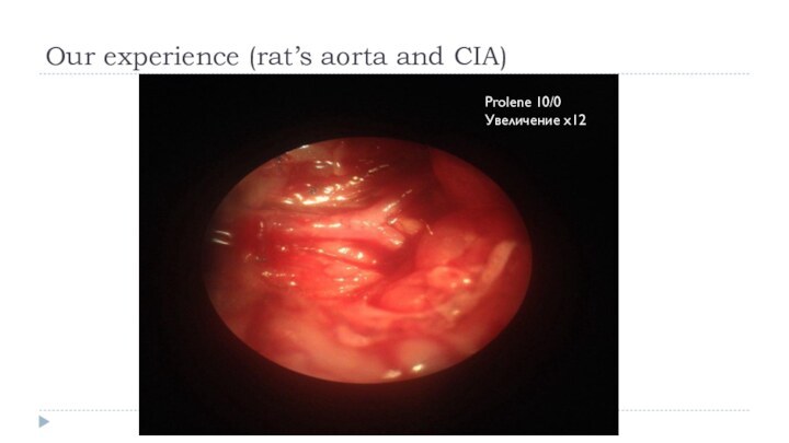 Our experience (rat’s aorta and CIA)AortaProlene 10/0Увеличение х12