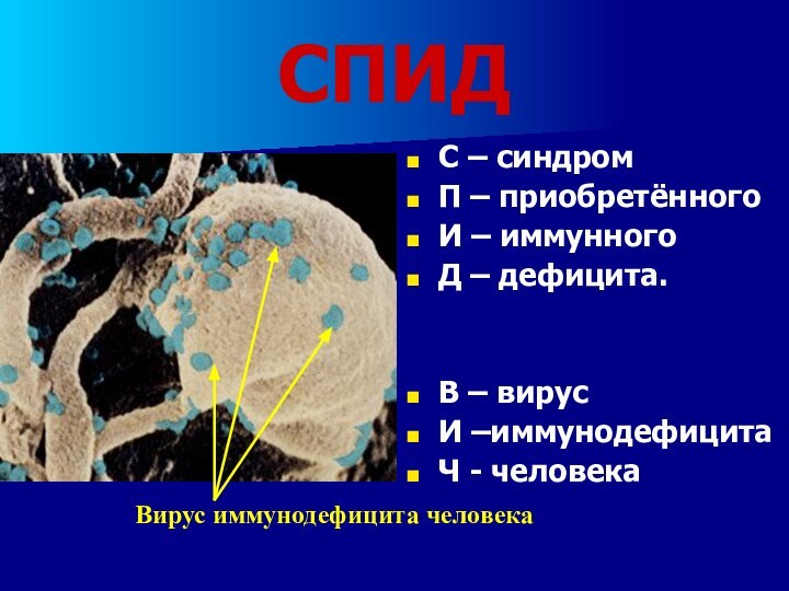 СПИДС – синдромП – приобретённогоИ – иммунногоД – дефицита.В – вирусИ –иммунодефицитаЧ - человекаВирус иммунодефицита человека