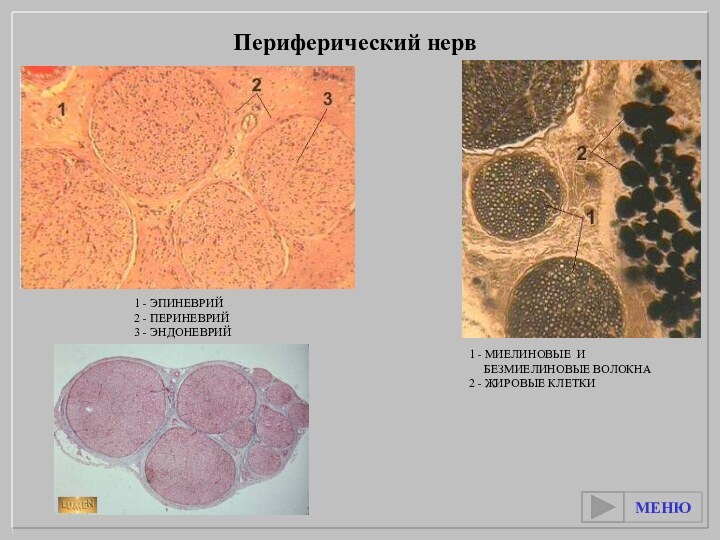 1 - МИЕЛИНОВЫЕ И   БЕЗМИЕЛИНОВЫЕ ВОЛОКНА2 - ЖИРОВЫЕ КЛЕТКИ1 -