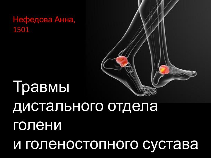 Травмы дистального отдела голени и голеностопного суставаНефедова Анна,  1501