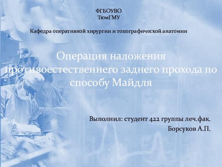 Выполнил: студент 422 группы леч.фак.Борсуков А.П.Операция наложения противоестественнего заднего прохода по способу