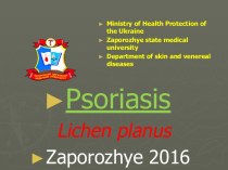 Psoriasis. Classification of psoriasis