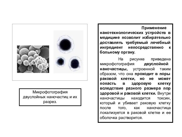 Применение нанотехнологических устройств в медицине позволит избирательно доставлять требуемый лечебный