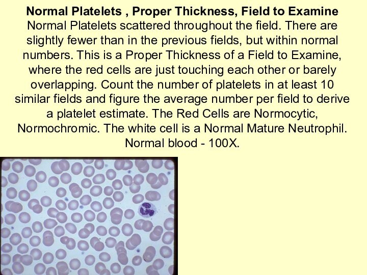 Normal Platelets , Proper Thickness, Field to Examine Normal Platelets scattered throughout