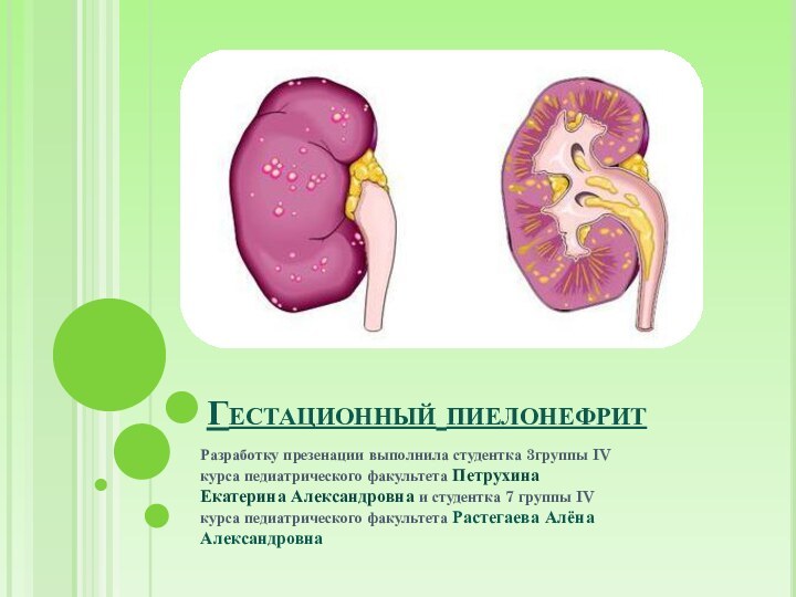 Гестационный пиелонефритРазработку презенации выполнила студентка 3группы IV курса педиатрического факультета Петрухина Екатерина