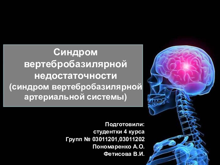 Синдром вертебробазилярной недостаточности (синдром вертебробазилярной артериальной системы)Подготовили:студентки 4 курсаГрупп № 03011201,03011202Пономаренко А.О.Фетисова В.И.