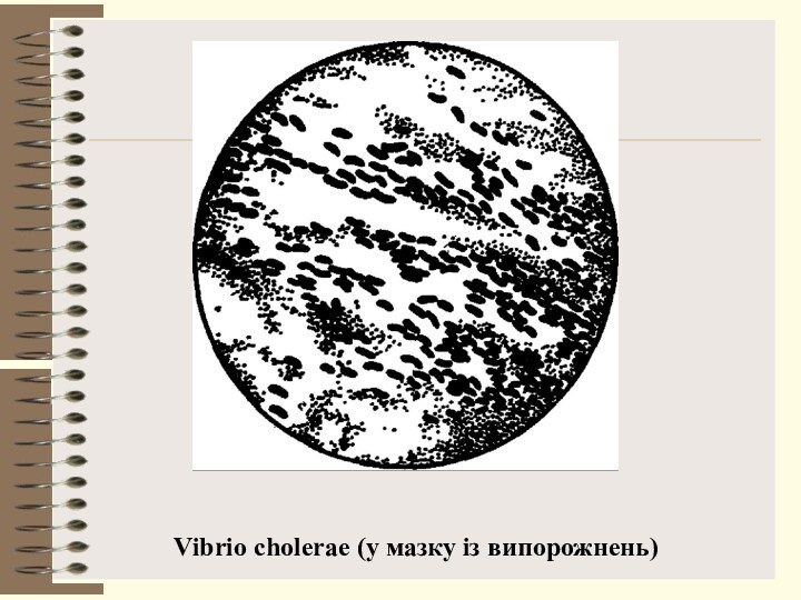 Vibrio cholerae (у мазку із випорожнень)