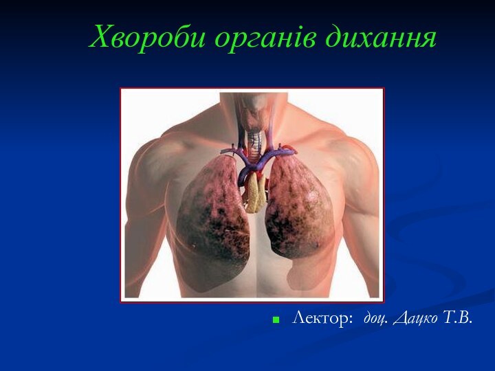 Хвороби органів диханняЛектор: доц. Дацко Т.В.