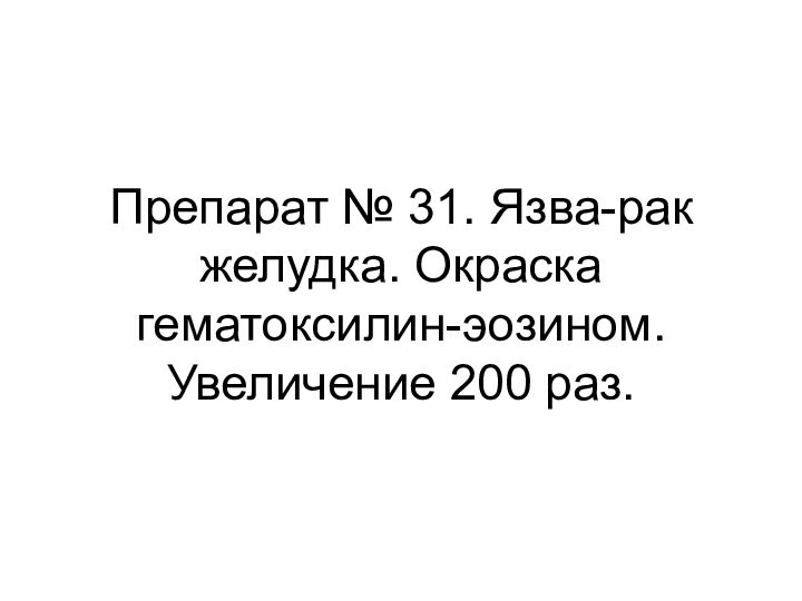 Препарат № 31. Язва-рак желудка. Окраска гематоксилин-эозином. Увеличение 200 раз.