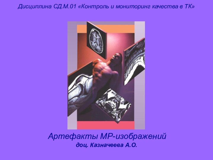 Артефакты МР-изображенийДисциплина СД.М.01 «Контроль и мониторинг качества в ТК»доц. Казначеева А.О.