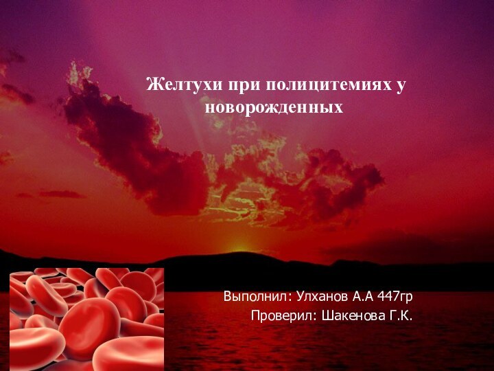 Выполнил: Улханов А.А 447грПроверил: Шакенова Г.К. Желтухи при полицитемиях у новорожденных