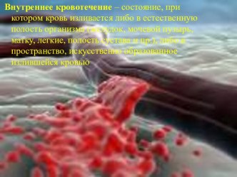 Внутреннее кровотечение – состояние, при котором кровь изливается в естественную полость организма