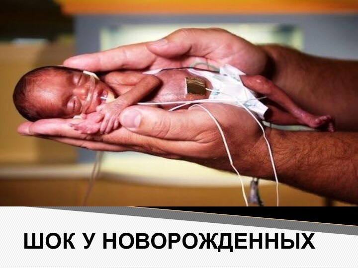 ШОК У НОВОРОЖДЕННЫХ