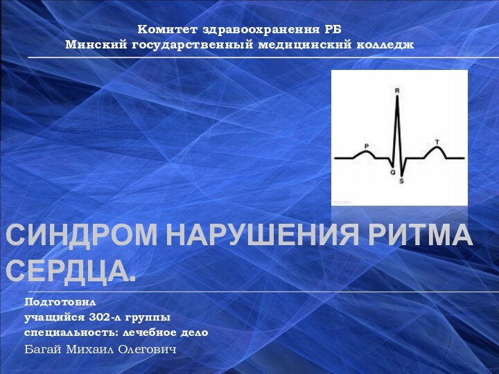 СИНДРОМ НАРУШЕНИЯ РИТМА СЕРДЦА.Подготовил учащийся 302-л группыспециальность: лечебное делоБагай Михаил ОлеговичКомитет здравоохранения РБМинский государственный медицинский колледж